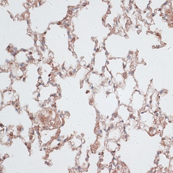 Vimentin Antibody抗体,orb1258103