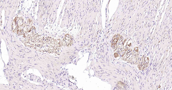 Tau-4 Mouse Monoclonal Antibod