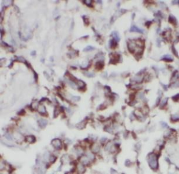 VPS18 Antibody抗体，orb632536，bio