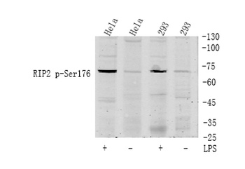 RIP2 (phospho Ser176) rabbit p