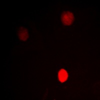 CTBP1 Antibody抗体,orb256481,bio