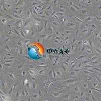 人肝窦内皮细胞永生化
