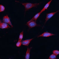 DDAH1 Antibody抗体，orb411719，bio