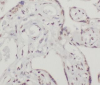 TFEB Antibody抗体，orb631840，bior