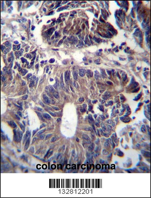 ZFYVE19 Antibody抗体，orb1269225，