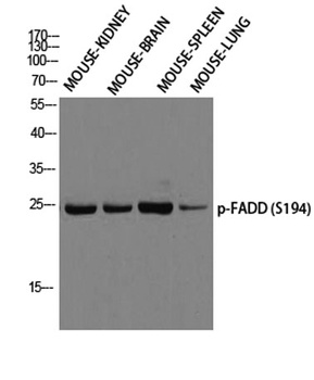 FADD (phospho Ser194) rabbit p