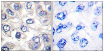 Cleaved-Bad (D71) rabbit pAb抗体