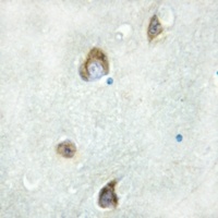 AHA1 Antibody抗体,orb215003,bior