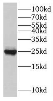 TNNI1 Antibody抗体，orb632027，bio