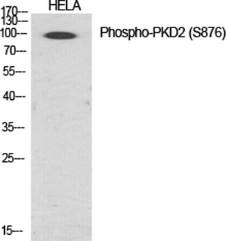 PKD2 (phospho Ser876) rabbit p
