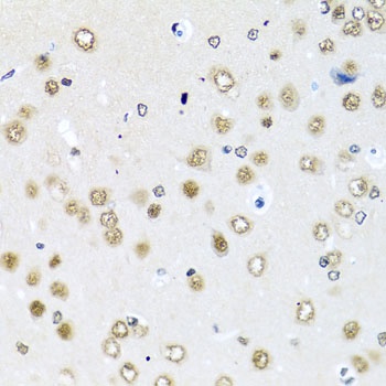 RAB3IP Antibody抗体，orb1256000，b