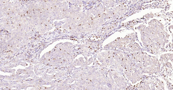 5 Lipoxygenase Recombinant Rab