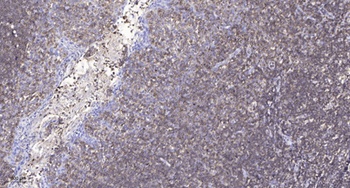 cGKII rabbit pAb抗体,orb764841,b