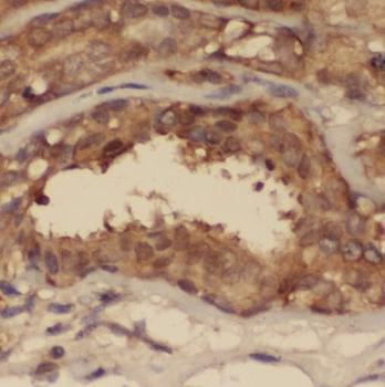 STAT2 Antibody抗体，orb631563，bio