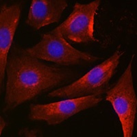 Thymidylate Synthase Antibody抗