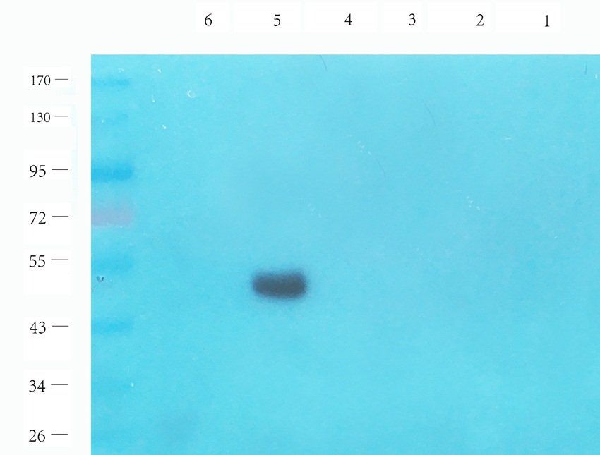 LAG3 antibody抗体，orb6286，biorby