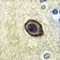 CD115 (Phospho-Y561) Antibody抗