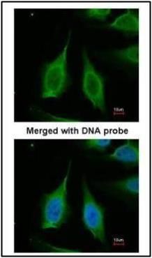 PPA1 antibody抗体，orb556725，bior