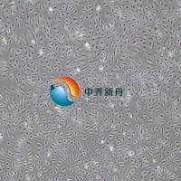 人真皮微血管内皮细胞永生化(成人)