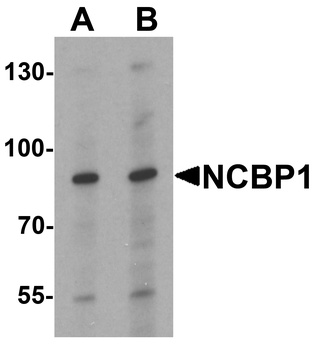 NCBP1 Antibody抗体，orb1239391，bi