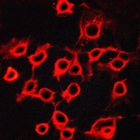 CCRL2 Antibody抗体,orb214850,bio