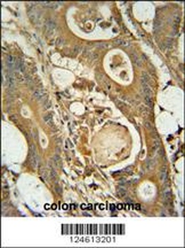 GCNT3 Antibody抗体，orb1270469，bi