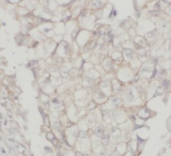 ABCC1 Antibody抗体，orb632880，bio