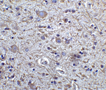 FOXP3 Antibody抗体，orb1239781，bi