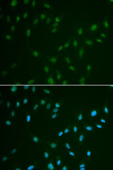 HSF2 Antibody抗体，orb1258066，bio