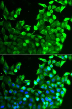 FGFR2 Antibody抗体，orb1254693，bi