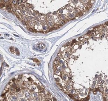 UBQLNL Antibody抗体，orb632337，bi