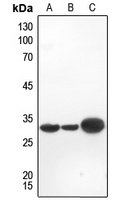 Galectin 3 Antibody [KO/KD Val