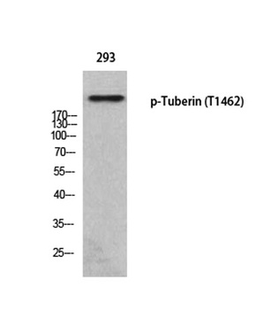 Tuberin (phospho Thr1462) rabb