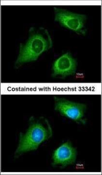 Fukutin antibody [N3C3-2]抗体，or