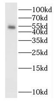 SMAD5 Antibody抗体，orb631309，bio