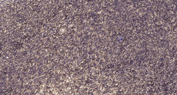 ATP5I rabbit pAb抗体，orb764604，b