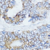 Cytochrome P450 19A1 Antibody抗