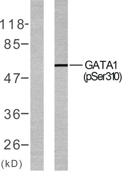 GATA-1 (phospho Ser310) rabbit