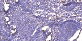 SFT2D2 rabbit pAb抗体,orb768872,