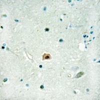 SOX8 Antibody抗体，orb665742，bior