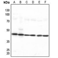 Nucleophosmin Antibody抗体，orb21