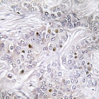 MEF2C Antibody抗体，orb665745，bio