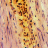 Beta-glucosidase 2 Antibody抗体，