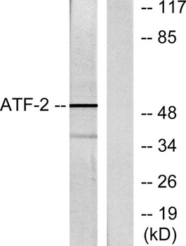 ATF-2 rabbit pAb抗体，orb764596，b