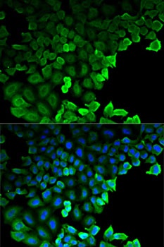 G6PD Antibody抗体，orb1260152，bio