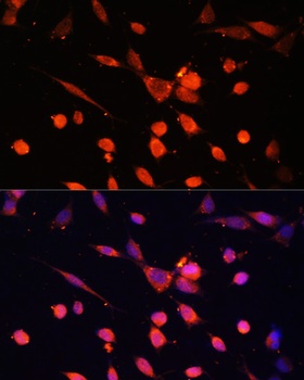 PIK3R3 Antibody抗体，orb1258765，b