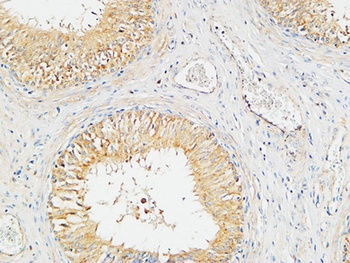 Plasminogen rabbit pAb抗体，orb76