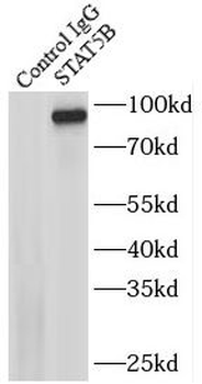 STAT5B Antibody抗体，orb631572，bi