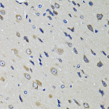 RBP4 Antibody抗体，orb1260891，bio