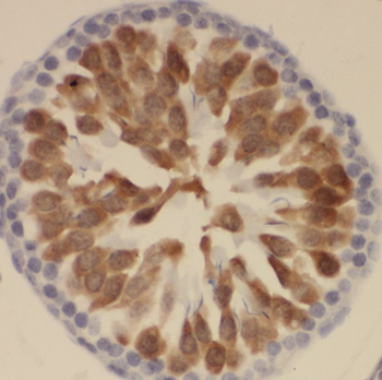 SSX4 Antibody抗体，orb631532，bior